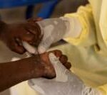 First case of more contagious mpox found outside Africa