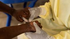 First case of more contagious mpox found outside Africa