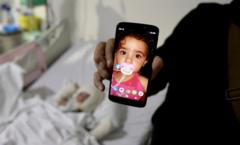 Lebanon: Father describes moment Israeli missile caused daughter’s third-degree burns