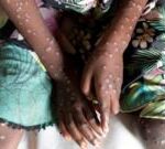 Central African Republic latest to declare mpox outbreak