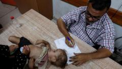 Baby contracts Gaza’s first case of polio in 25 years